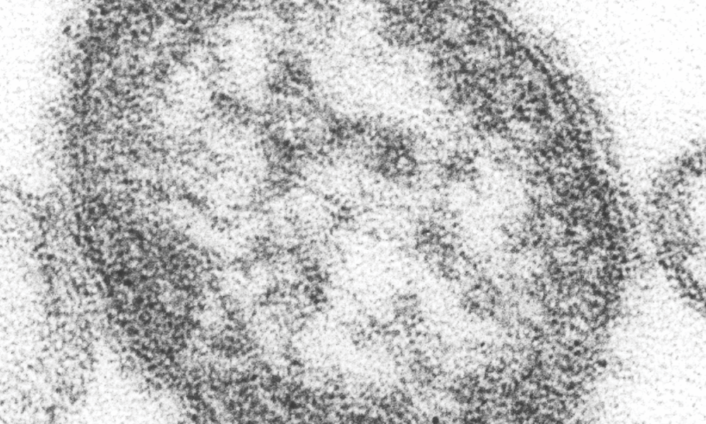 Measles virus infecting a cell